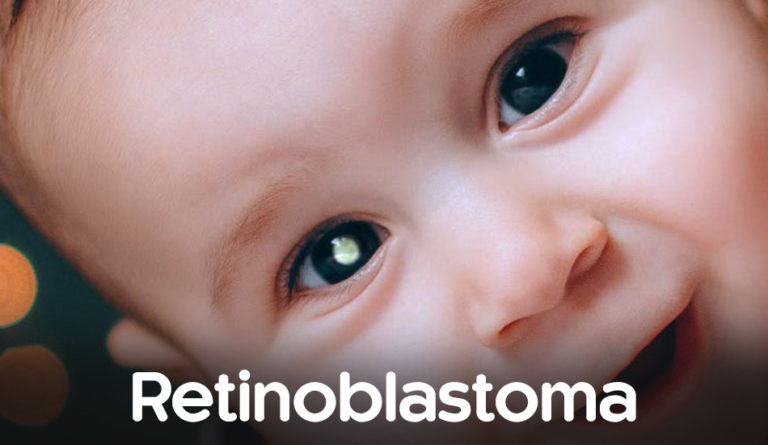 Retinoblastoma e a importância do diagnóstico precoce